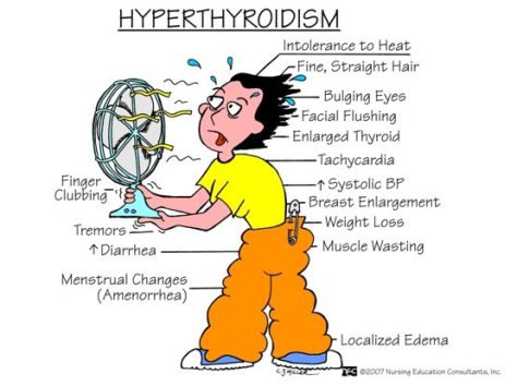 hyperthyroidism