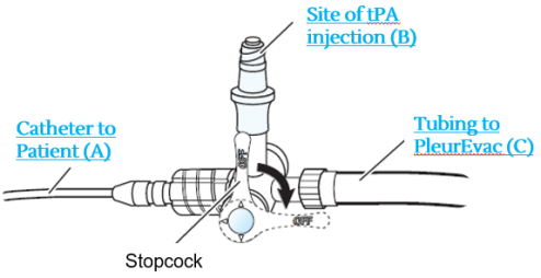 Chest Tube